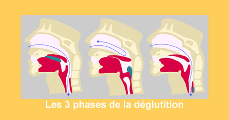 LA DYSPHAGIE